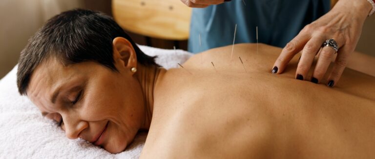 Women having acupuncture to ease backpain